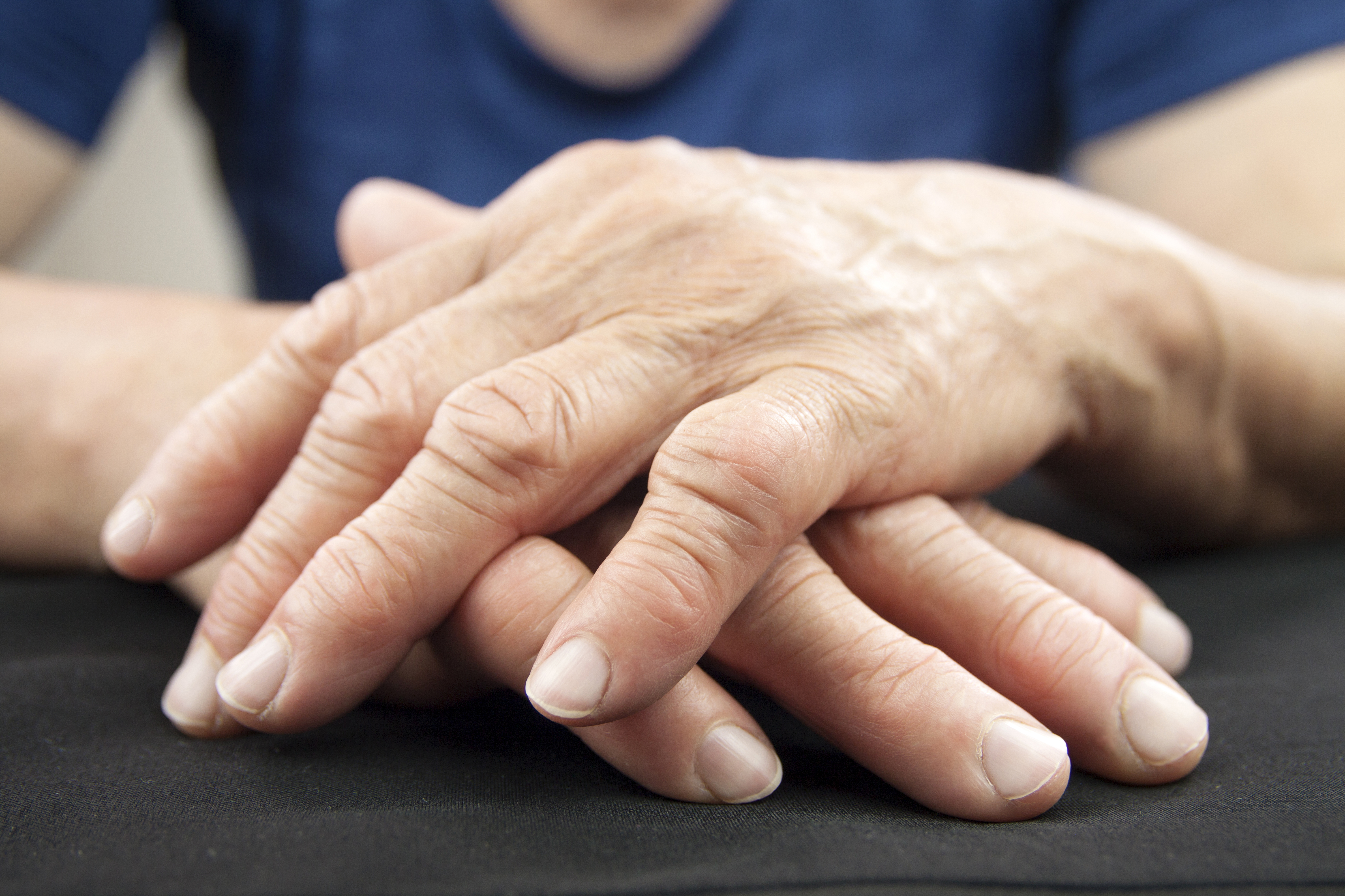 Лечение артрита рук препараты