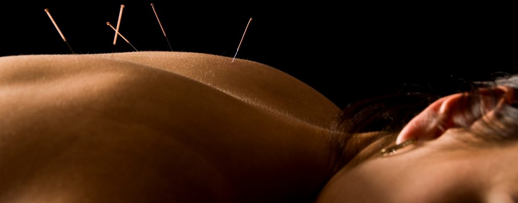 photo of lady receiving relaxing acupuncture treatment